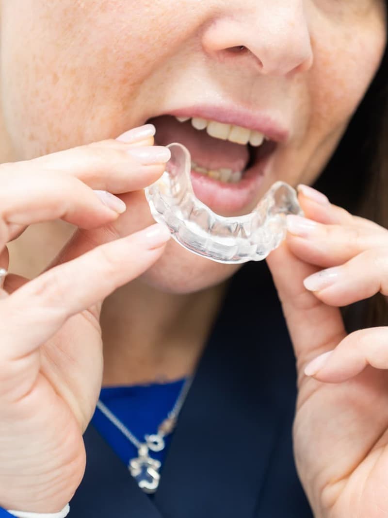 Especialistas en tratamiento para el bruxismo en Redondela