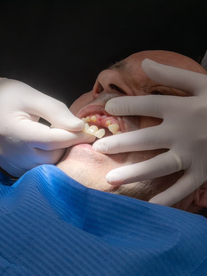 Protege tu sonrisa con coronas y puentes dentales en Redondela