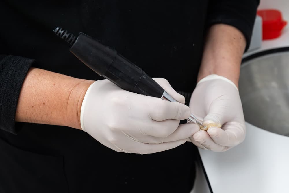 ¿Qué son las coronas dentales y puentes?