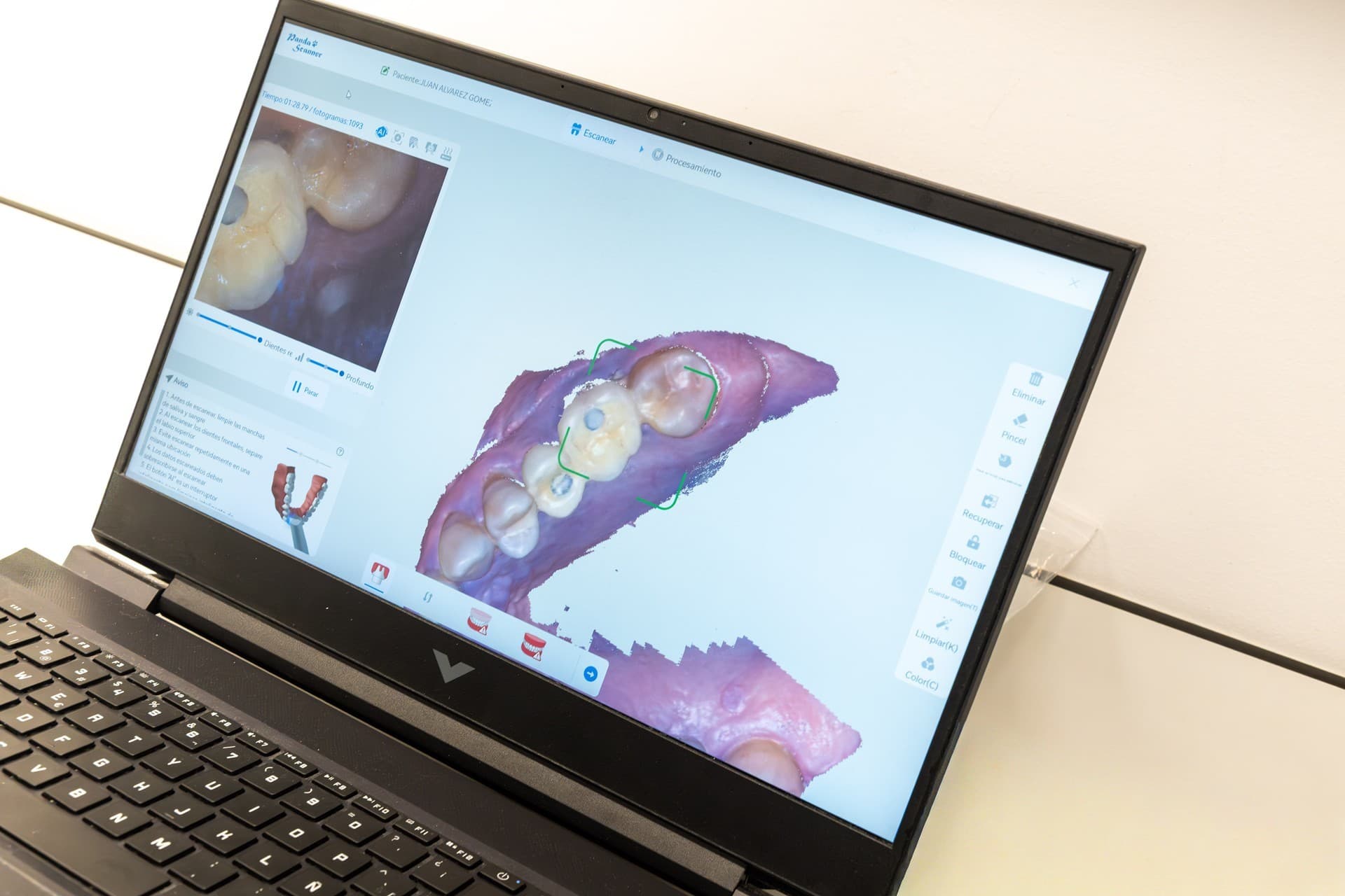 ¡Diseña tu sonrisa con odontología digital en Redondela!