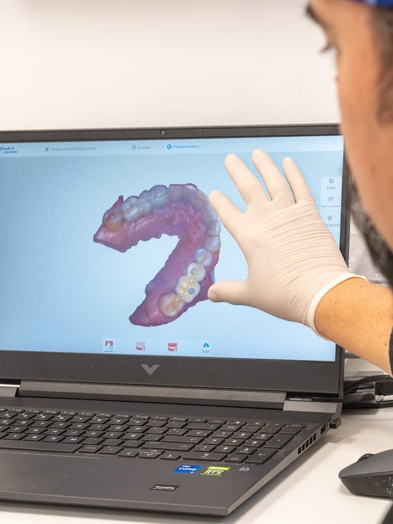 Diseñamos tu tratamiento con odontología digital en Redondela
